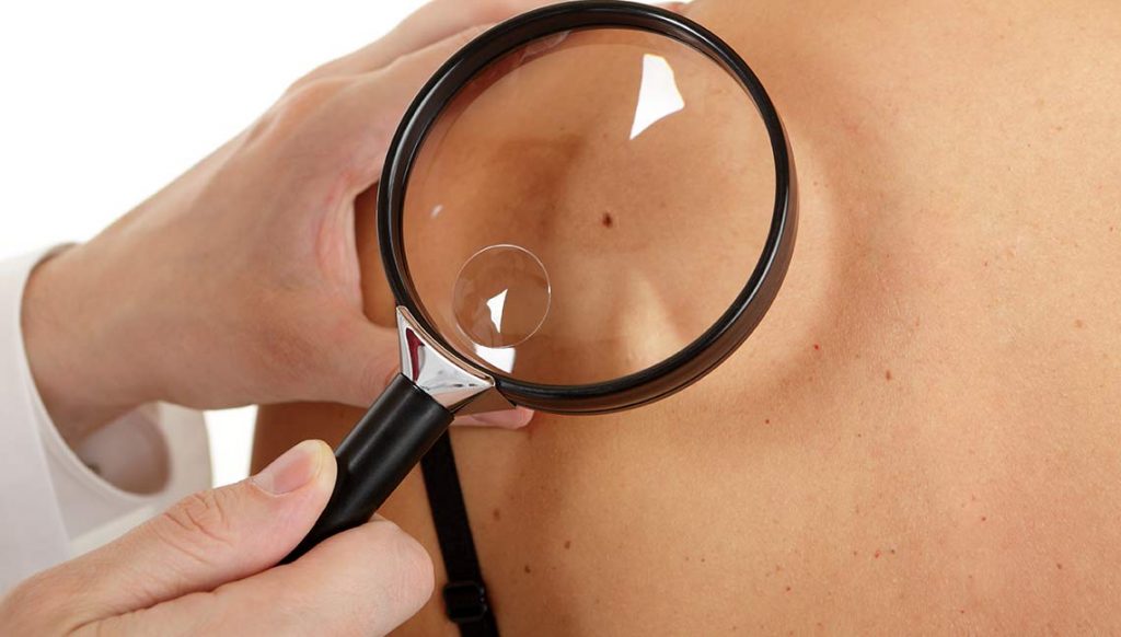A skin specialist looking for spots of skin cancer in a skin cancer clinic in Melbourne
