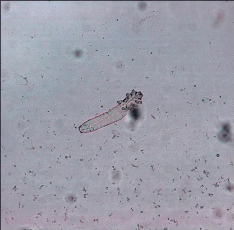 A single Demodex folliculorum mite under light microscopy — an elongated, cigar-shaped body recovered from a skin scrape