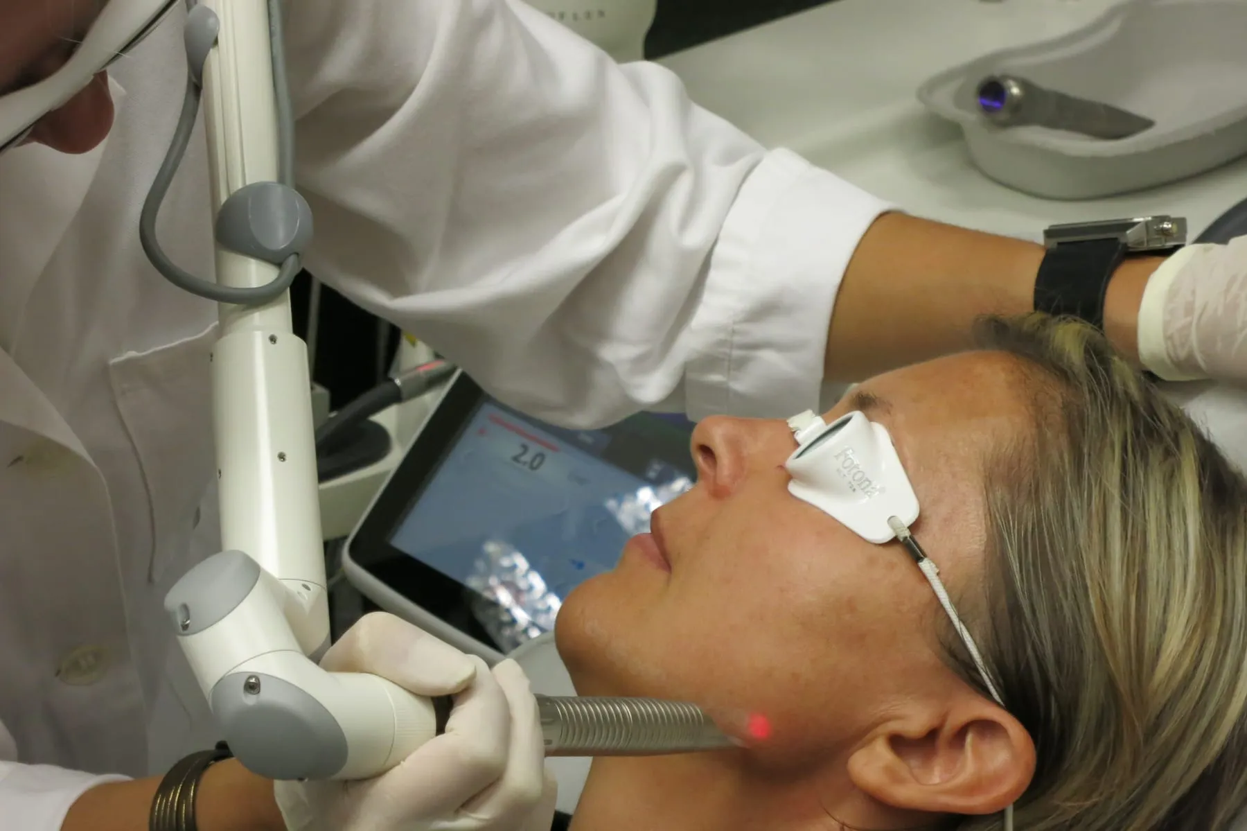 A Fotona 4D non-surgical laser facial treatment in progress