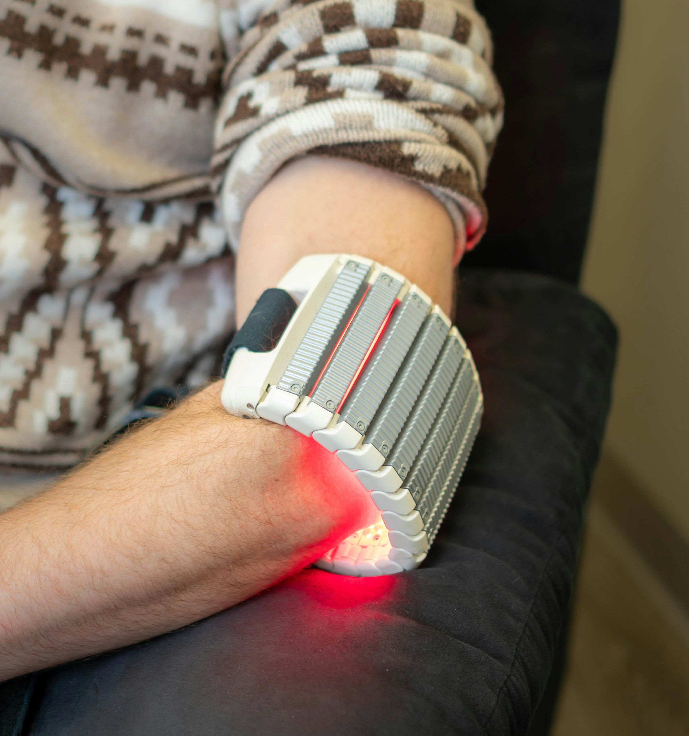 Red light therapy device applied to a patient's arm — the LED activation step used in laser-assisted photodynamic therapy.