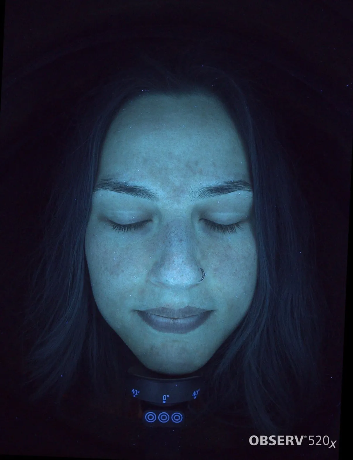 A fluorescence skin-imaging capture from the Observ system, mapping pigment and oil beneath the skin surface